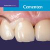 Cementen