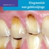Diagnostiek van gebitsslijtage