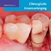 Chirurgische kroonverlenging