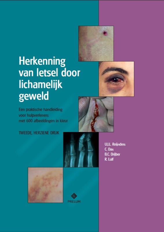 Herkenning van letsel door lichamelijk geweld