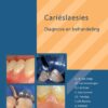 Carieslaesies (studenteneditie)